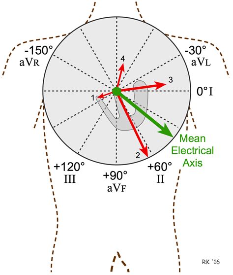 mean electrical axis formula